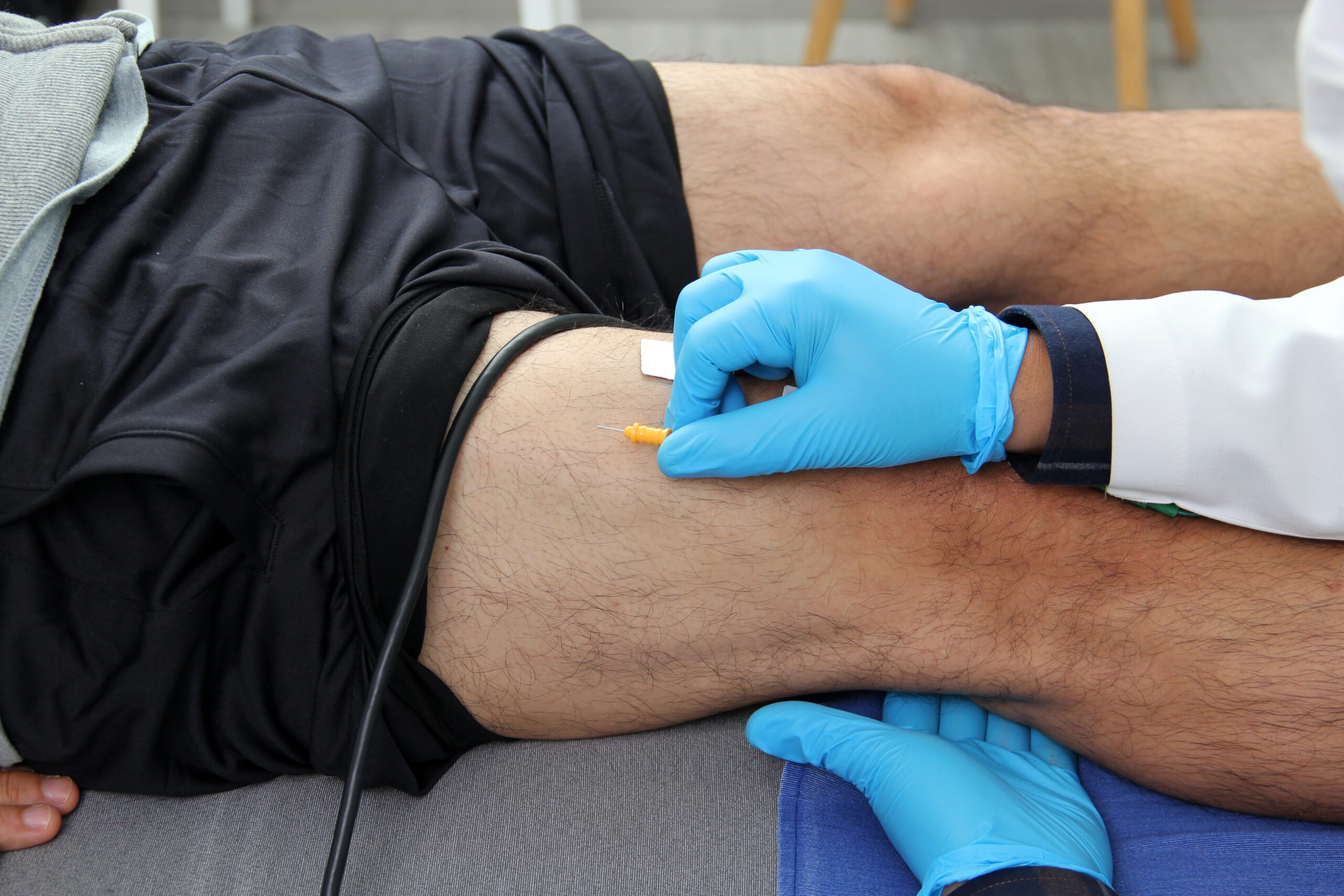 Common Conditions Diagnosed With EMG/NCS